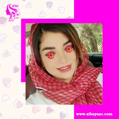 نمونه جراحی بینی سعیدرضا نوری